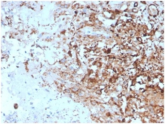 TIM3/HAVCR2/ CD366 (Effector T-Cell Marker) Antibody in Immunohistochemistry (Paraffin) (IHC (P))
