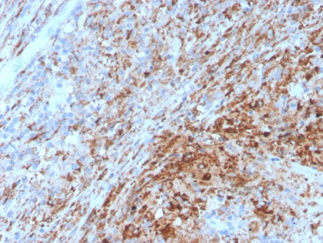TIM3/HAVCR2/CD366 Antibody in Immunohistochemistry (Paraffin) (IHC (P))