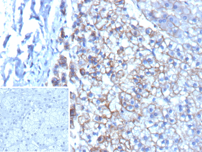 MRP3 (Multidrug Resistance-Associated Protein 3) Antibody in Immunohistochemistry (Paraffin) (IHC (P))
