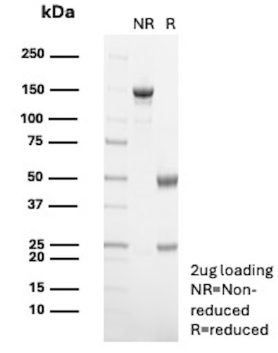 Cyclin A2/CCNA2 (Marker of Tumor Proliferation) Antibody in SDS-PAGE (SDS-PAGE)