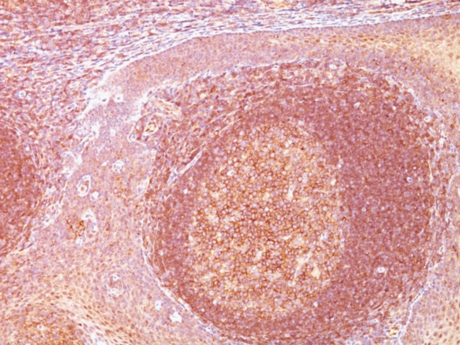 BCL10 (MALT-Lymphoma Marker) Antibody in Immunohistochemistry (Paraffin) (IHC (P))