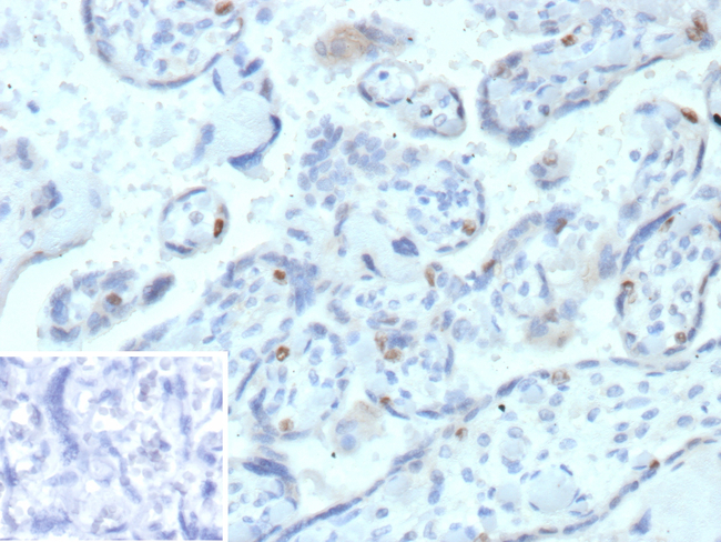 Cyclin E (G1/S-Phase Cyclin) Antibody in Immunohistochemistry (Paraffin) (IHC (P))