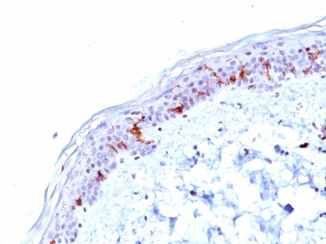CD1a/HTA1 (Mature Langerhans Cells Marker) Antibody in Immunohistochemistry (Paraffin) (IHC (P))