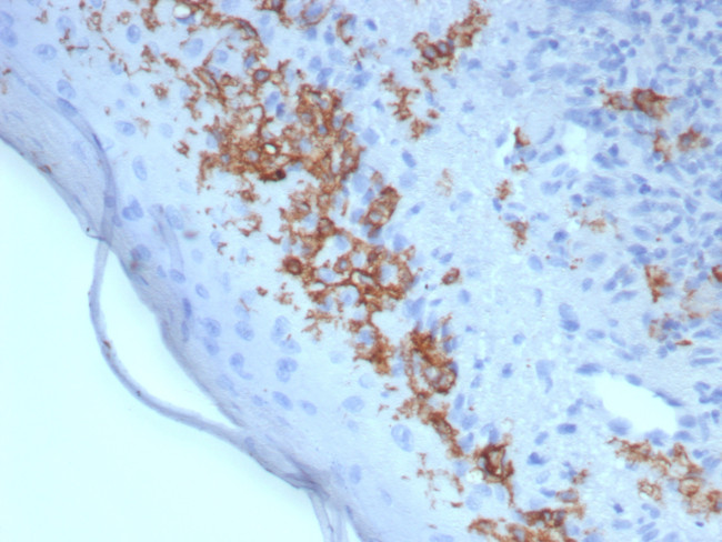 CD1a/HTA1 (Mature Langerhans Cells Marker) Antibody in Immunohistochemistry (Paraffin) (IHC (P))