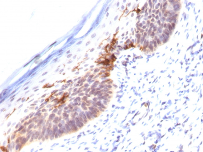 CD1a (Mature Langerhans Cells Marker) Antibody in Immunohistochemistry (Paraffin) (IHC (P))