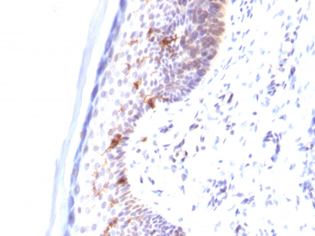 CD1a/HTA1 (Mature Langerhans Cells Marker) Antibody in Immunohistochemistry (Paraffin) (IHC (P))