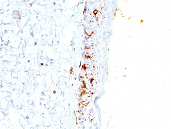 CD1a/HTA1 (Mature Langerhans Cells Marker) Antibody in Immunohistochemistry (Paraffin) (IHC (P))