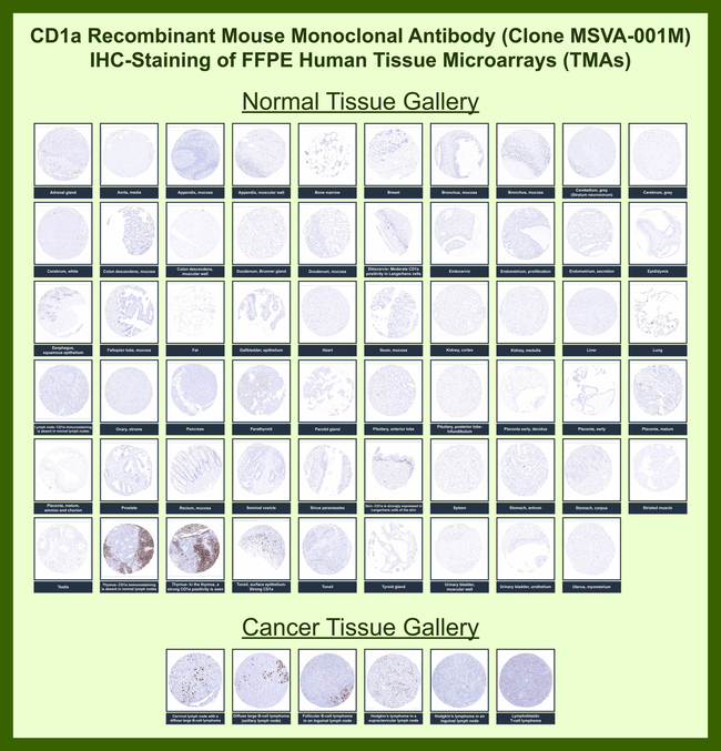 CD1a/HTA1 (Mature Langerhans Cells Marker) Antibody in Immunohistochemistry (Paraffin) (IHC (P))