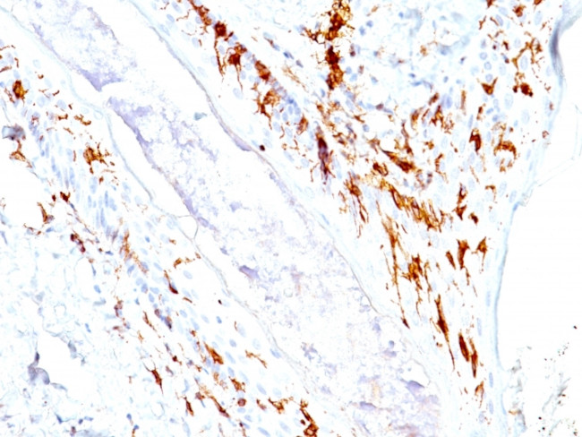 CD1a/HTA1 (Mature Langerhans Cells Marker) Antibody in Immunohistochemistry (Paraffin) (IHC (P))
