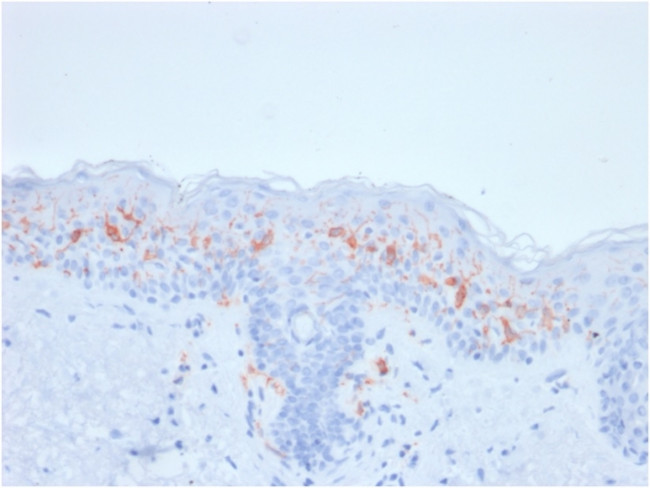 CD1a/HTA1 Antibody in Immunohistochemistry (Paraffin) (IHC (P))