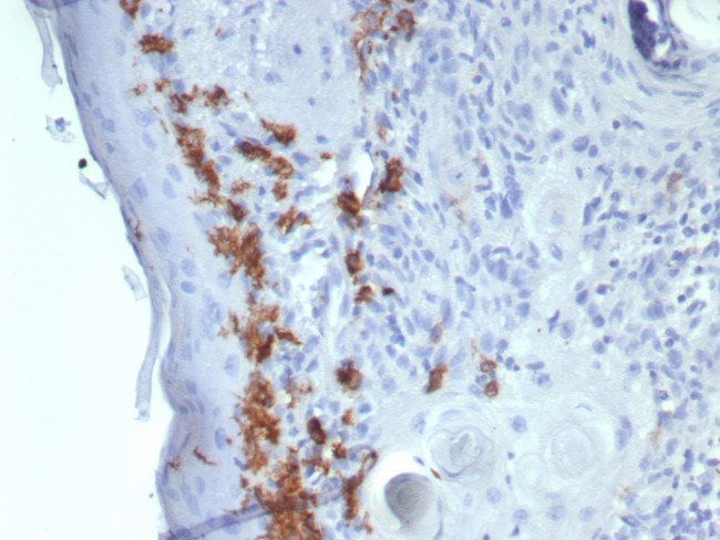 CD1a/HTA1 (Mature Langerhans Cells Marker) Antibody in Immunohistochemistry (Paraffin) (IHC (P))