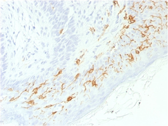 CD1a/HTA1 Antibody in Immunohistochemistry (Paraffin) (IHC (P))