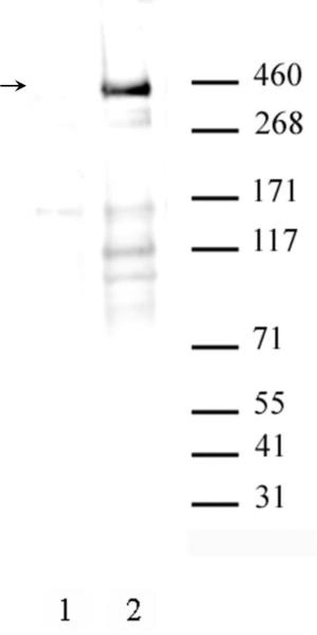 Phospho-ATM (Ser1981) Antibody in Western Blot (WB)