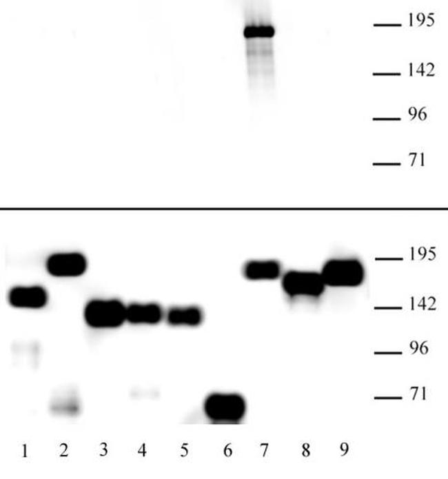 KDM5A Antibody in Western Blot (WB)