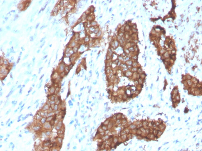 PDZ and LIM Domain 1 Antibody in Immunohistochemistry (Paraffin) (IHC (P))