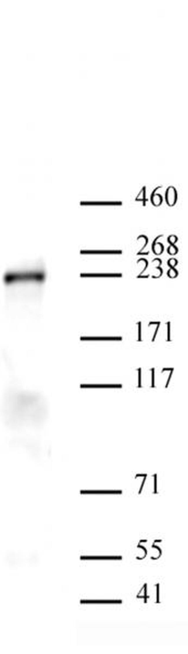 Dicer Antibody in Western Blot (WB)