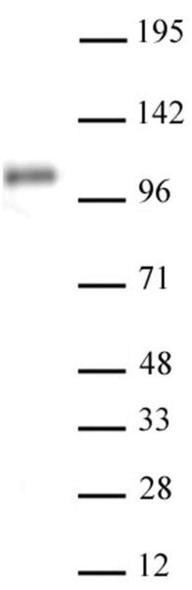 Notch1 Antibody in Western Blot (WB)