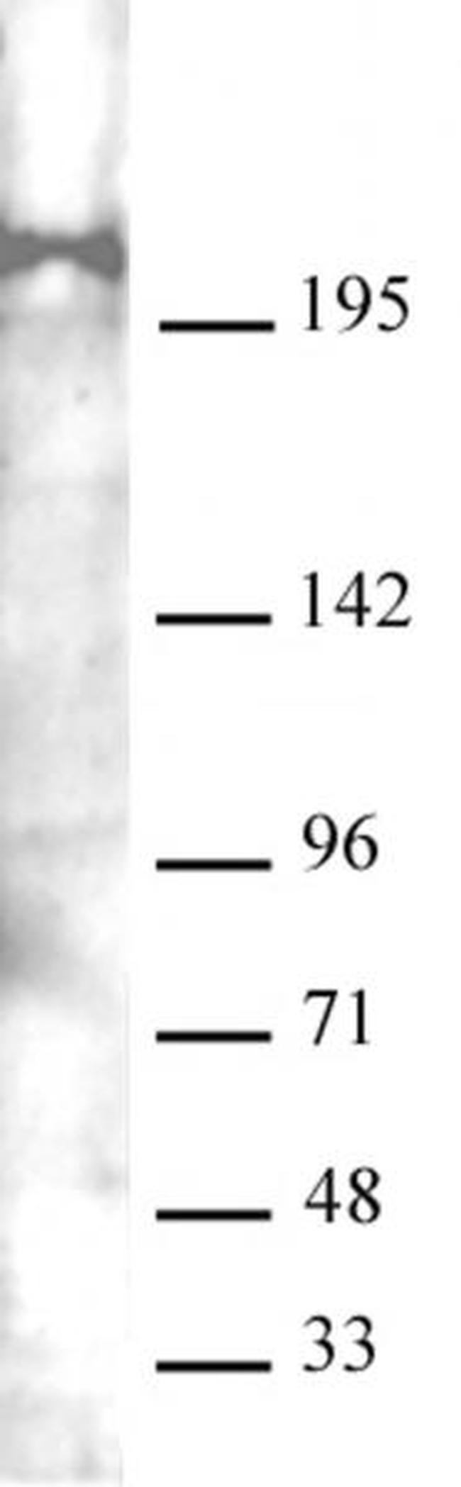 Mi-2 beta (CHD4) Antibody in Western Blot (WB)