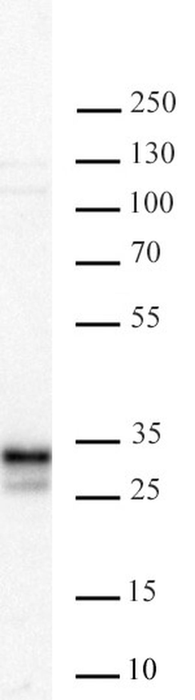 ING5 Antibody in Western Blot (WB)
