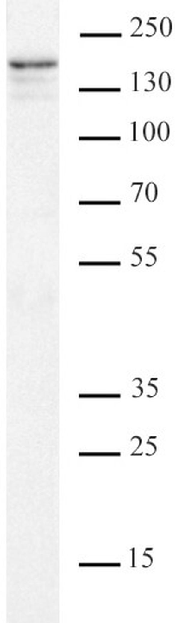 Supt5H/SPT5 Antibody in Western Blot (WB)