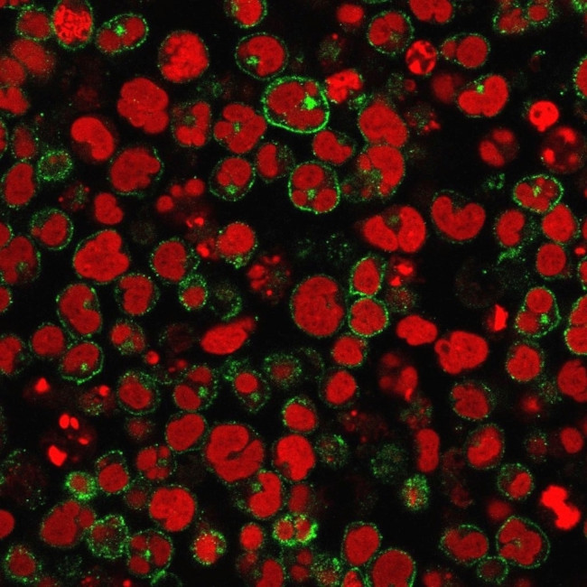 CD2/Lymphocyte Function Antigen 2 (LFA-2) Antibody in Immunocytochemistry (ICC/IF)