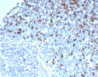 CD2/Lymphocyte Function Antigen 2 (LFA-2) Antibody in Immunohistochemistry (Paraffin) (IHC (P))