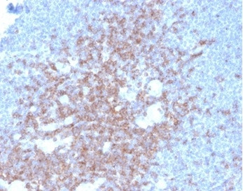 CD2/Lymphocyte Function Antigen 2 (LFA-2) Antibody in Immunohistochemistry (Paraffin) (IHC (P))