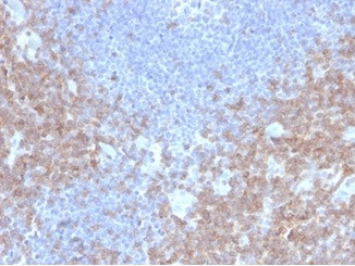CD2/Lymphocyte Function Antigen 2 (LFA-2) Antibody in Immunohistochemistry (Paraffin) (IHC (P))