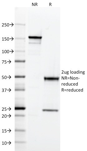 CD2/Lymphocyte Function Antigen 2 (LFA-2) Antibody in SDS-PAGE (SDS-PAGE)