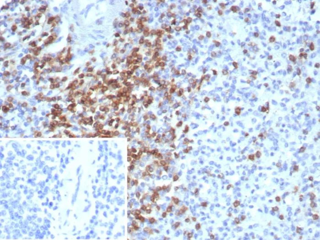 CD2/Lymphocyte Function Antigen 2 (LFA-2) Antibody in Immunohistochemistry (Paraffin) (IHC (P))