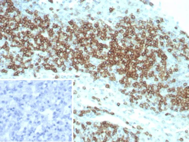 CD2/Lymphocyte Function Antigen 2 (LFA-2) Antibody in Immunohistochemistry (Paraffin) (IHC (P))
