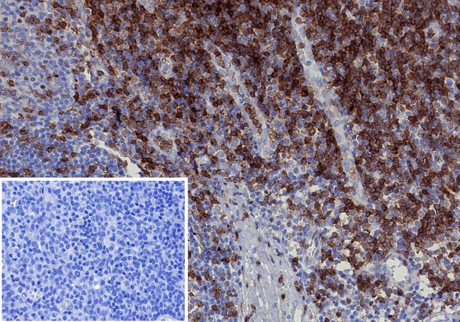 CD2/Lymphocyte Function Antigen 2 (LFA-2) Antibody in Immunohistochemistry (Paraffin) (IHC (P))