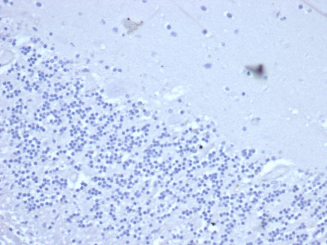 CD2/Lymphocyte Function Antigen 2 (LFA-2) Antibody in Immunohistochemistry (Paraffin) (IHC (P))