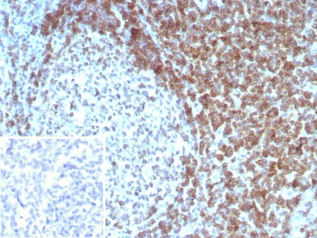 CD3D/T Cell Receptor delta Antibody in Immunohistochemistry (Paraffin) (IHC (P))