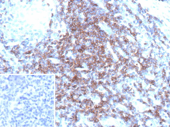 CD3D/T Cell Receptor delta Antibody in Immunohistochemistry (Paraffin) (IHC (P))