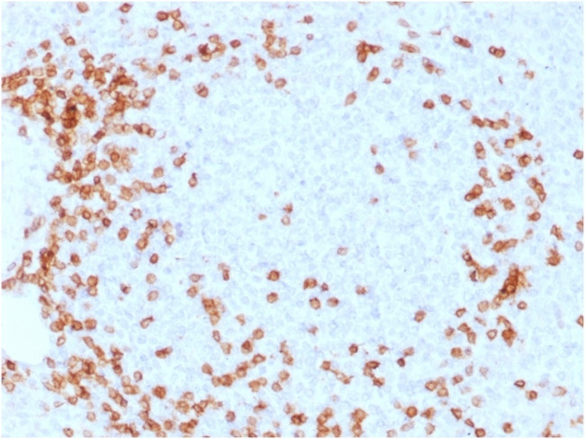 CD3e Antibody in Immunohistochemistry (Paraffin) (IHC (P))