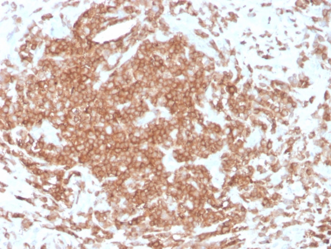 CD3e (T-Cell Marker) Antibody in Immunohistochemistry (Paraffin) (IHC (P))