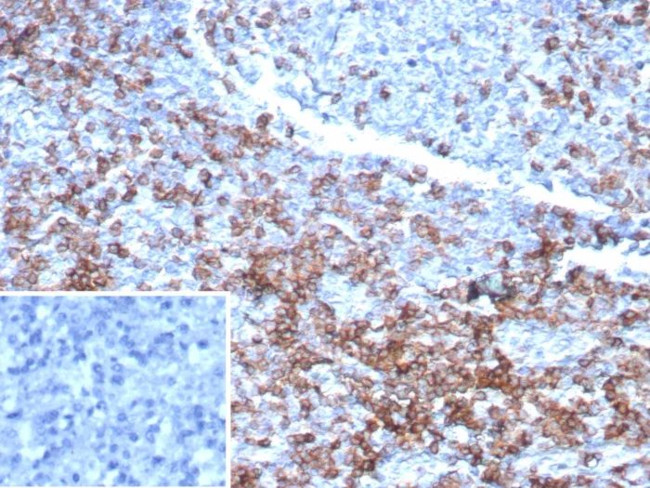 CD3e (T-Cell Marker) Antibody in Immunohistochemistry (Paraffin) (IHC (P))