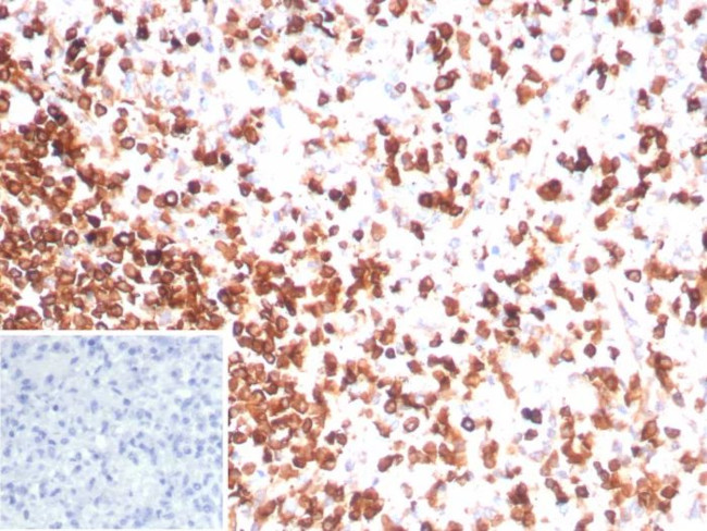 CD3e (T-Cell Marker) Antibody in Immunohistochemistry (Paraffin) (IHC (P))
