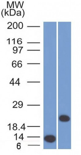 CD3e (T-Cell Marker) Antibody in Western Blot (WB)