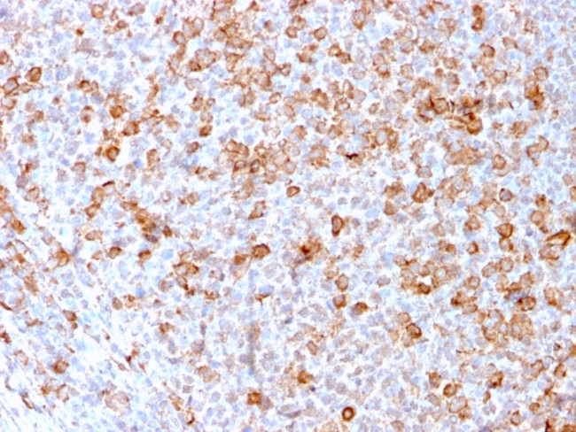 CD3e (T-Cell Marker) Antibody in Immunohistochemistry (Paraffin) (IHC (P))