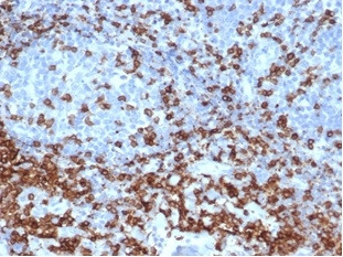 CD3e (T-Cell Marker) Antibody in Immunohistochemistry (Paraffin) (IHC (P))