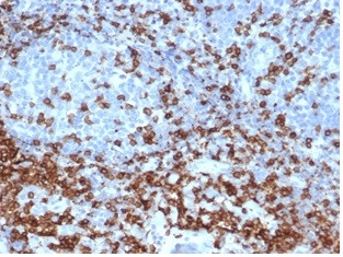 CD3e (T-Cell Marker) Antibody in Immunohistochemistry (Paraffin) (IHC (P))