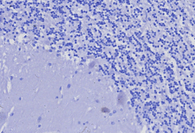 CD3e (T-Cell Marker) Antibody in Immunohistochemistry (Paraffin) (IHC (P))