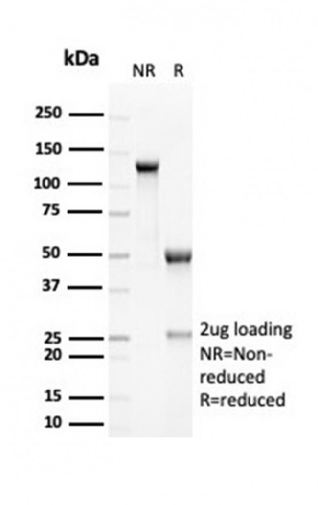 RCAS1/Estrogen Receptor Binding Site Associated Antigen 9