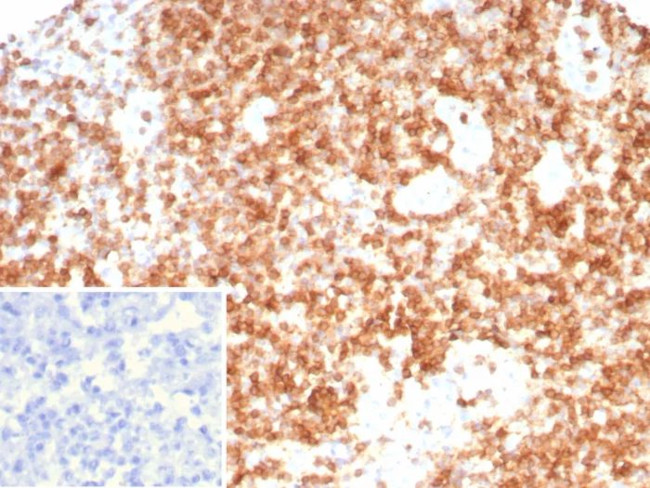 CD3G/CD3beta1/TCR beta Antibody in Immunohistochemistry (Paraffin) (IHC (P))
