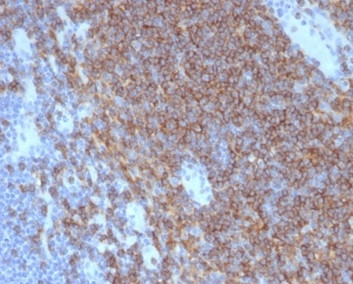 CD4 (T-Helper/Inducer Cell Marker) Antibody in Immunohistochemistry (Paraffin) (IHC (P))