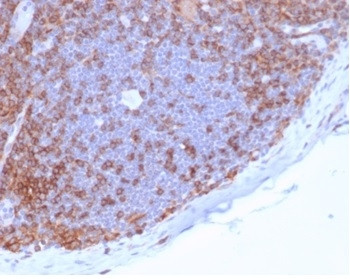 CD4 (T-Helper/Inducer Cell Marker) Antibody in Immunohistochemistry (Paraffin) (IHC (P))