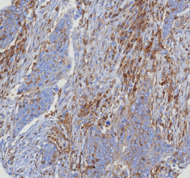 CD4 (T-Helper/Inducer Cell Marker) Antibody in Immunohistochemistry (Paraffin) (IHC (P))