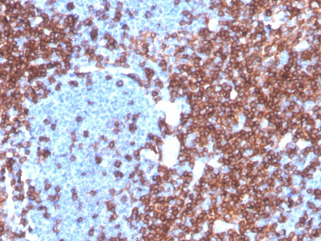 CD4 Antibody in Immunohistochemistry (Paraffin) (IHC (P))